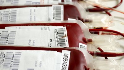 Обласний центр крові потребує кров усіх груп і резусів