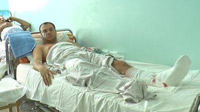 Пошкодження кісток та ампутація: що відомо про стан травмованих внаслідок обстрілу ТЦ у Кременчуці Пошкодження кісток та ампутація: що відомо про стан травмованих внаслідок обстрілу ТЦ у Кременчуці
