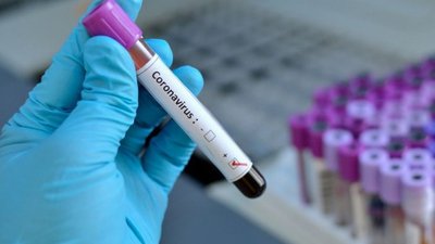 За добу захворювання на COVID-19 підтвердили у 792 мешканців Одещини