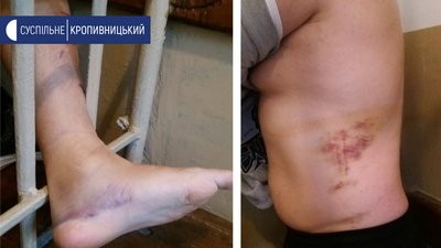 У Кропивницькому працівники СІЗО побили ув’язнених: прокуратура відкрила кримінальне провадження