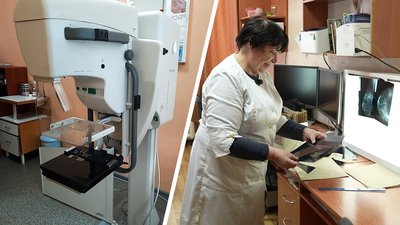 Рак молочної залози. Які обстеження потрібно робити щороку — пояснюють лікарі з Кіровоградщини