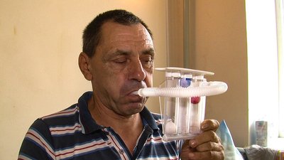 ”Добре, що вчасно діагностували”. У жителя Кіровоградщини виявили рак, коли досліджували на COVID ”Добре, що вчасно діагностували”. У жителя Кіровоградщини виявили рак, коли досліджували на COVID