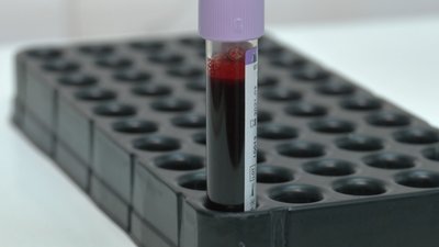 На Черкащині за добу виявили 17 інфікованих на COVID-19