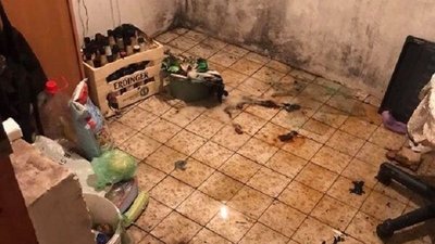 У Львові під час пожежі жінка отримала опіки 60% тіла