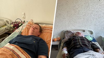 "Живіт почав пекти, я поповзла від машини": свідчення волонтерів, поранених під час обстрілу РФ у Липцях