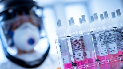 Коронавірус виявили у 242 жителів Сумщини, четверо - померли