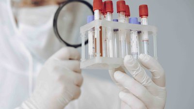 310 нових випадків захворювання на COVID-19 на Херсонщині, понад 15 тисяч - в Україні