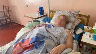 У лікарні Кривого Рогу рятують двох жінок, що потрапили під обстріл армії РФ у Зеленодольську У лікарні Кривого Рогу рятують двох жінок, що потрапили під обстріл армії РФ у Зеленодольську