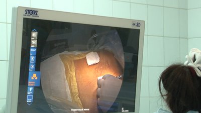 Перші в області, другі в Україні: черкаські онкологи оперують з новим обладнанням