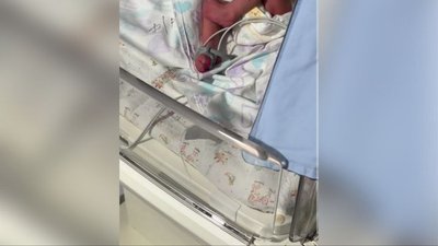 Рідкісний випадок в пологовому у Рівному