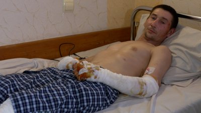 "Вогонь зі стелі пішов": що розповів поранений під час ракетного удару по Одесі