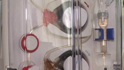 стоять у черзі на нирки стоять у черзі на нирки
