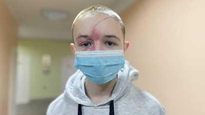 Стас отримав поранення через влучання ракети в будинок Стас отримав поранення через влучання ракети в будинок