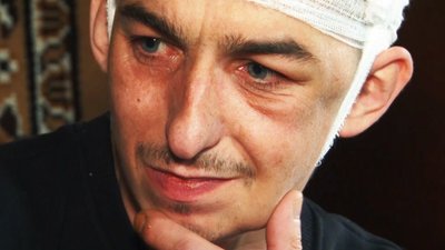 Інформують та оформлюють документи: як на Вінниччині мобільна бригада допомагає пораненим захисникам Інформують та оформлюють документи: як на Вінниччині мобільна бригада допомагає пораненим захисникам
