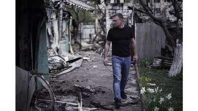 "До лікарні могли дістатися лише ті, кого не постріляли по дорозі" — лікарі Бучі "До лікарні могли дістатися лише ті, кого не постріляли по дорозі" — лікарі Бучі
