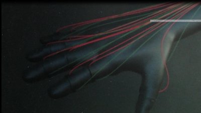 Вінницькі студенти створили рукавичку для реабілітації пацієнтів з травмованими руками Вінницькі студенти створили рукавичку для реабілітації пацієнтів з травмованими руками