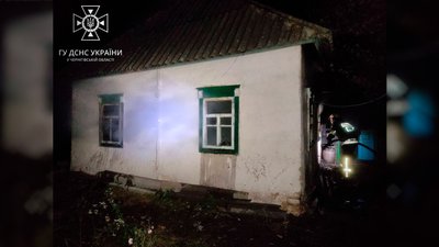 На Чернігівщині під час пожежі житлового будинку травмувалася дитина На Чернігівщині під час пожежі житлового будинку травмувалася дитина
