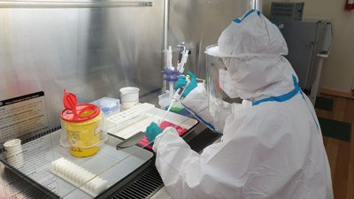 Кіровоградщина має майже дві сотні тестів для виявлення мавпячої віспи. Медики пройшли навчання
