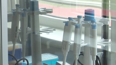 90 проб за зміну. У Сумах відкрили міську ПЛР-лабораторію 90 проб за зміну. У Сумах відкрили міську ПЛР-лабораторію