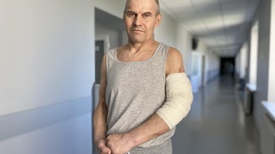 Відсутні 10 см плечової кістки: львівські лікарі врятували руку жителю Донеччини