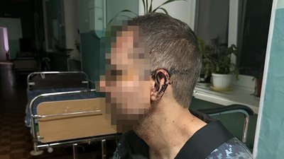 В одній із військових частин на Одещині побили військового: ДБР почало розслідування