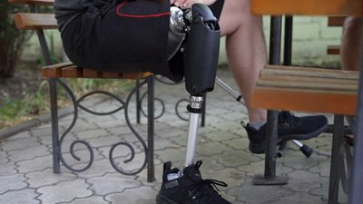 У Дніпрі виготовляють протези для бійців та цивільних і навчають ними користуватися У Дніпрі виготовляють протези для бійців та цивільних і навчають ними користуватися