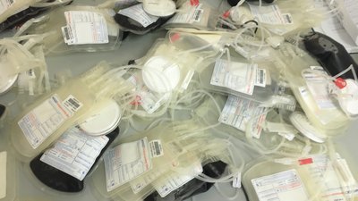 Житомирському обласному центру крові потрібні донори Житомирському обласному центру крові потрібні донори