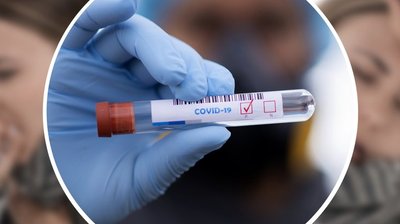 COVID-19 на Сумщині: підтвердили ще 158 інфікувань, четверо людей померли