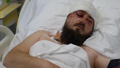 Поранений військовий, уламок БпЛА пробив череп, Дмитро