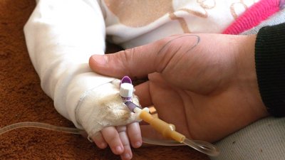 "Дитина хоче жити". На Франківщині у 7-місячної дівчинки діагностували рідкісне захворювання "Дитина хоче жити". На Франківщині у 7-місячної дівчинки діагностували рідкісне захворювання