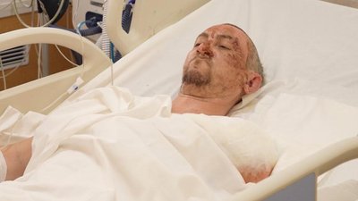 поранений військовий, боєць з Одещини Олександр, лікування