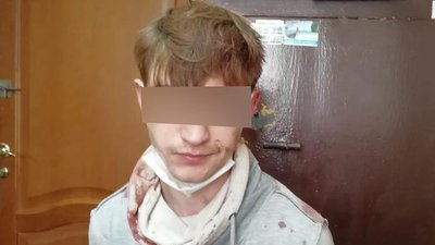 Тернополянина, який поранив ножем матір та вітчима, затримали патрульні