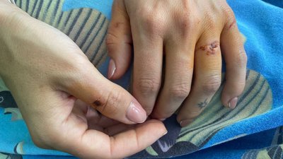 "Пам’ятаю тільки на дотик": у Диканьці на Полтавщині невідомий травмував жінку "Пам’ятаю тільки на дотик": у Диканьці на Полтавщині невідомий травмував жінку