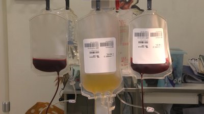 У Львові медики готуються до проведення трансплантацій кісткового мозку У Львові медики готуються до проведення трансплантацій кісткового мозку