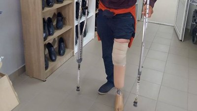 Активісти допомогли безхатченку отримати протез Активісти допомогли безхатченку отримати протез