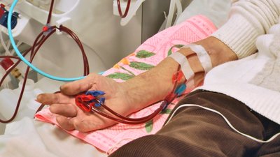 Пацієнти Хмельниччини продовжують отримувати послуги гемодіалізу