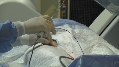 Продовжить життя пацієнтам: у Житомирі запустили нове обладнання для лікування пацієнтів із вадами серця Продовжить життя пацієнтам: у Житомирі запустили нове обладнання для лікування пацієнтів із вадами серця