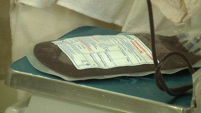 У Фастові проведуть день донора крові для потреб українських військових