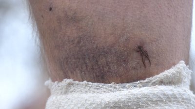 У Городищі місцевого жителя покусали собаки