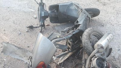На Житомирщині у ДТП отримав травми підліток на мопеді На Житомирщині у ДТП отримав травми підліток на мопеді
