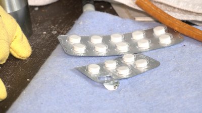 У Черкасах лікують людей з туберкульозом У Черкасах лікують людей з туберкульозом