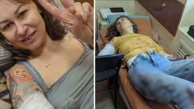 Наталія Матвєєва дістала поранень у Запоріжжі