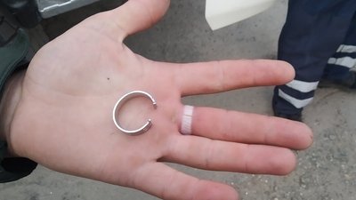 У Дніпрі рятувальники допомогли чоловіку зняти каблучку з пальця