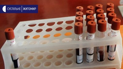 На Житомирщині за добу від COVID-19 одужала рекордна кількість жителів
