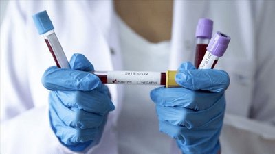 За добу коронавірус виявили у 20 жителів області, 20 хворих одужали