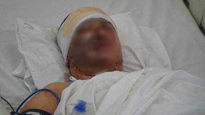 Нікополь, касирка, поранена, дрон, лікарня