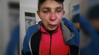 Хлопцеві, який на Тернопільщині побив двох інших, обрали запобіжний захід Хлопцеві, який на Тернопільщині побив двох інших, обрали запобіжний захід