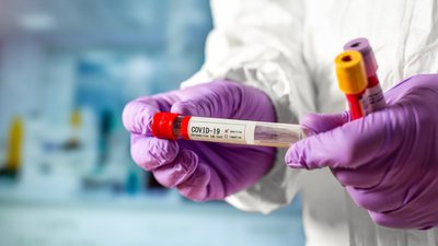 На Буковині від COVID-19 помер військослужбовець
