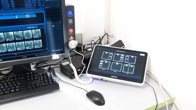 У міській лікарні Житомира встановили новий ангіограф У міській лікарні Житомира встановили новий ангіограф