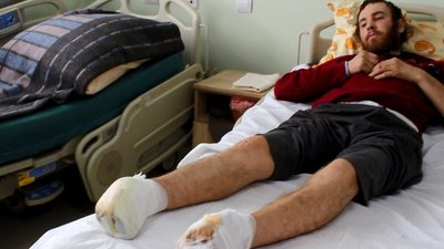 "Солдати Росії прив'язали до стовпа на морозі". Мешканцю Тростянця ампутували обидві стопи